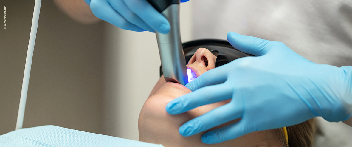 Intraoralscan – Foto: AdobeStock/Artur