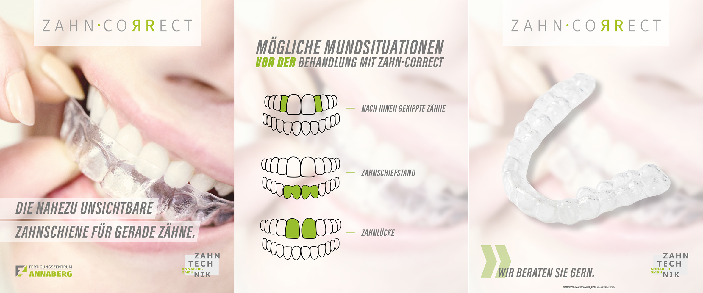 Visualisierung drei Motive zur Aligner-Behandlung und mögliche Mundsituationen